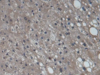 CYP3A7 Antibody in Immunohistochemistry (Paraffin) (IHC (P))