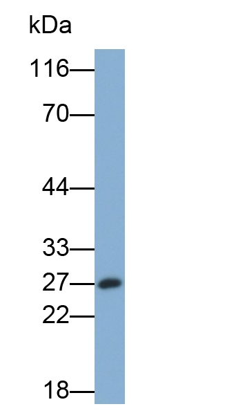GSTA3 Antibody in Western Blot (WB)