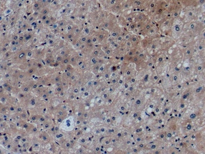CCL27 Antibody in Immunohistochemistry (Paraffin) (IHC (P))