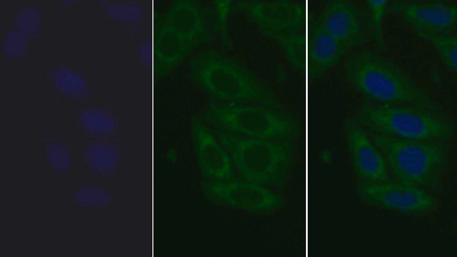 TLR2 Antibody in Immunocytochemistry (ICC/IF)