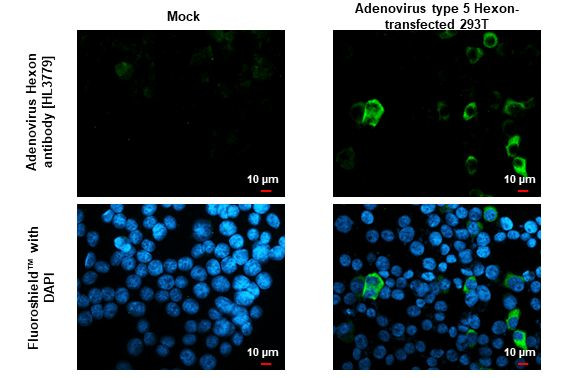 Adenovirus Hexon Antibody in Immunocytochemistry (ICC/IF)