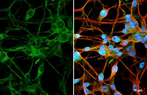 ENPP2 Antibody in Immunocytochemistry (ICC/IF)