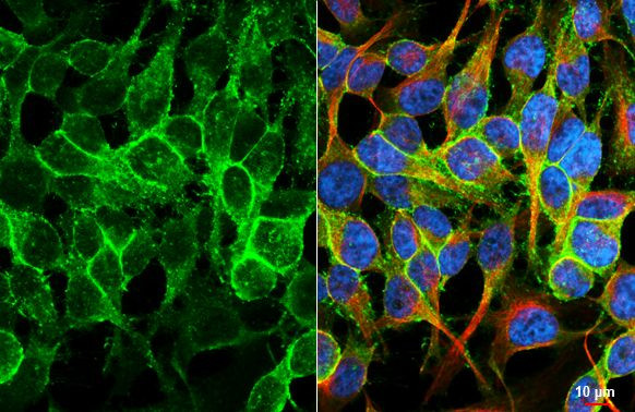 BASP1 Antibody in Immunocytochemistry (ICC/IF)