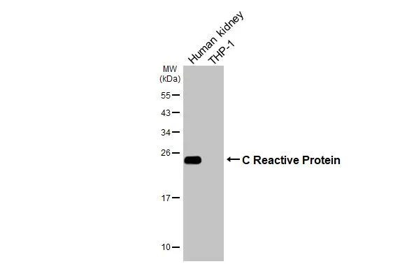 CRP Antibody in Western Blot (WB)