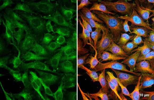 CASK Antibody in Immunocytochemistry (ICC/IF)