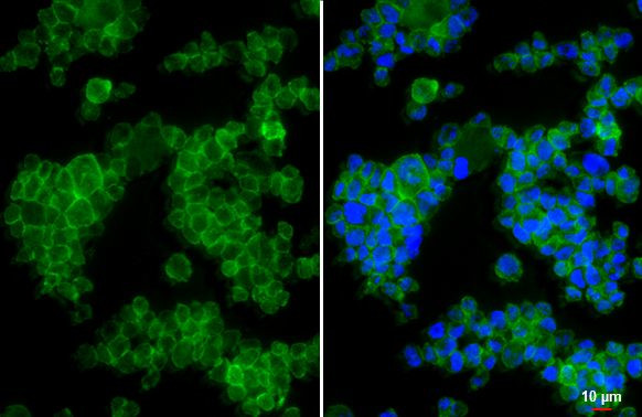 CCR1 Antibody in Immunocytochemistry (ICC/IF)