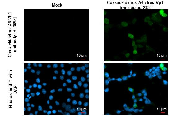 Coxsackievirus A6 VP1 Antibody in Immunocytochemistry (ICC/IF)