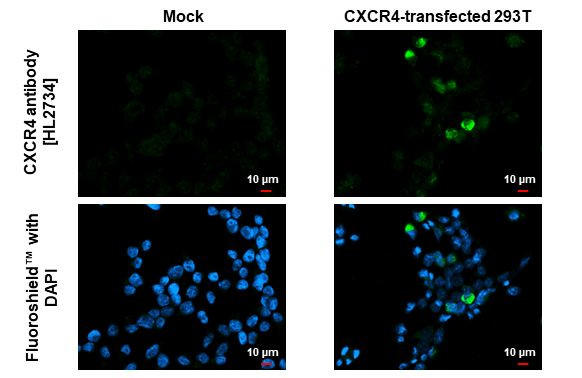 CXCR4 Antibody in Immunocytochemistry (ICC/IF)