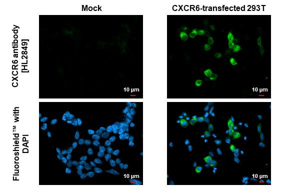 CXCR6 Antibody in Immunocytochemistry (ICC/IF)