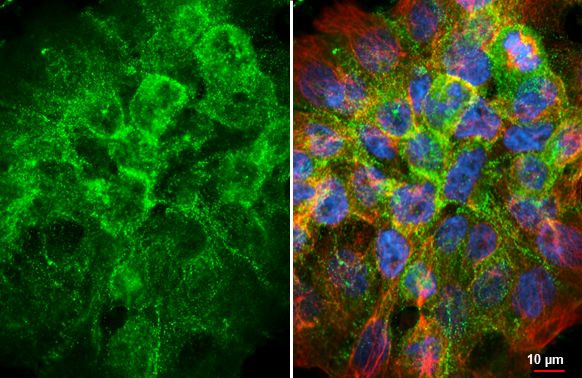 Desmocollin 2 Antibody in Immunocytochemistry (ICC/IF)