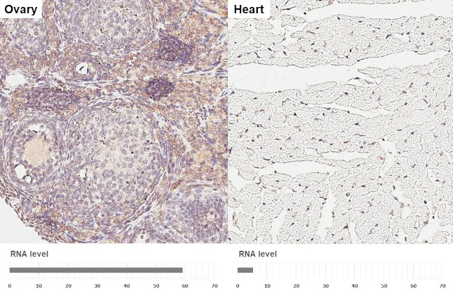 DHCR7 Antibody in Immunohistochemistry (Paraffin) (IHC (P))