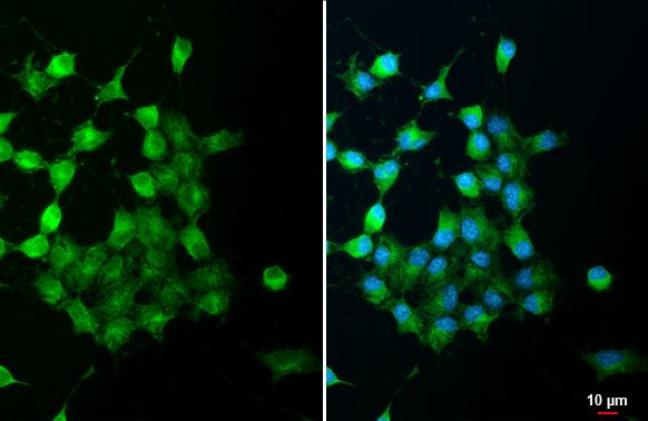 ZPK Antibody in Immunocytochemistry (ICC/IF)