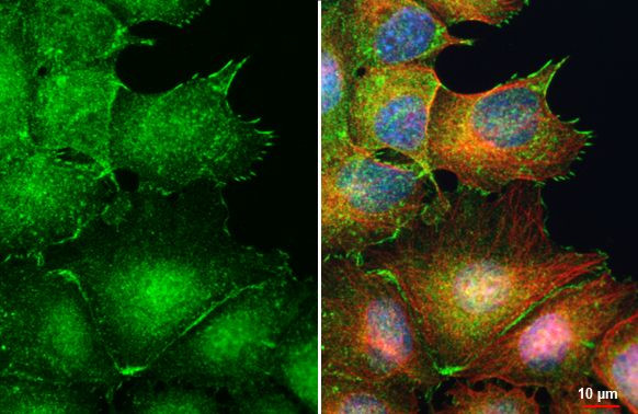 EDG4 Antibody in Immunocytochemistry (ICC/IF)