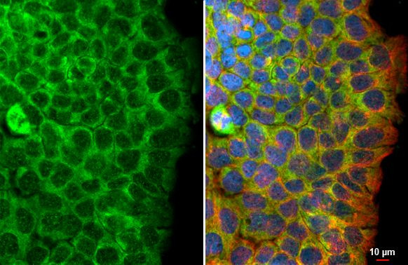 FLII Antibody in Immunocytochemistry (ICC/IF)