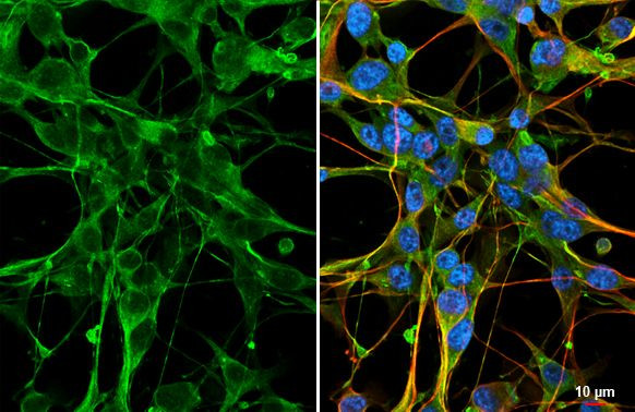 FSTL1 Antibody in Immunocytochemistry (ICC/IF)