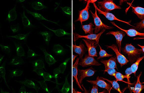 Golgin-97 Antibody in Immunocytochemistry (ICC/IF)