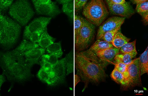 GPR120 Antibody in Immunocytochemistry (ICC/IF)