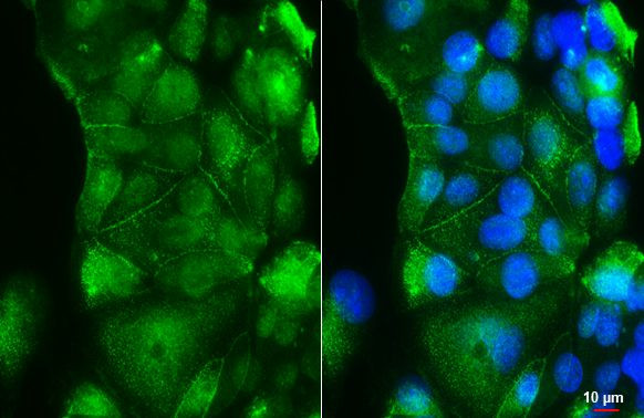 RAI3 Antibody in Immunocytochemistry (ICC/IF)