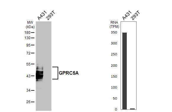 RAI3 Antibody in Western Blot (WB)