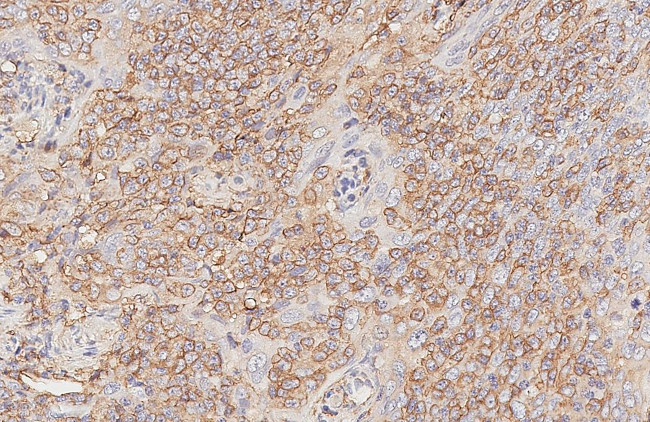 HLA-DQ Antibody in Immunohistochemistry (Paraffin) (IHC (P))
