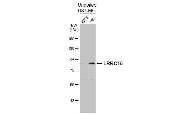 LRRC15 Antibody in Western Blot (WB)