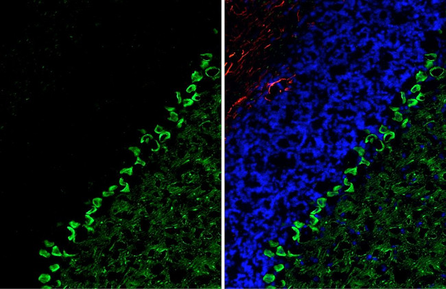 LRRK2 Antibody in Immunohistochemistry (Frozen) (IHC (F))