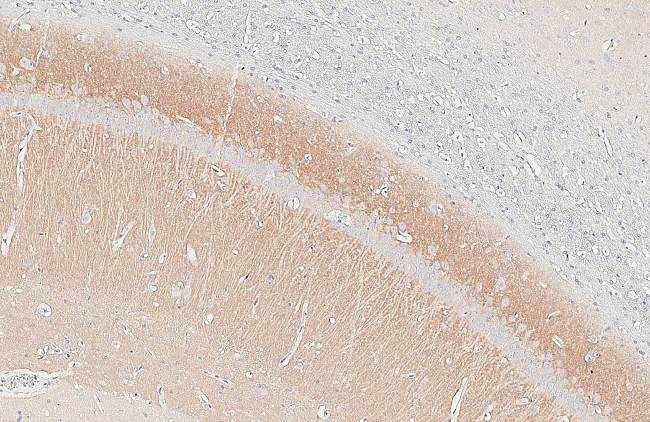 mGluR5 Antibody in Immunohistochemistry (Paraffin) (IHC (P))