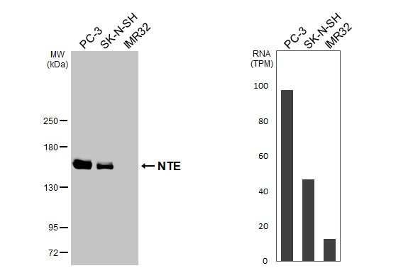 NTE Antibody in Western Blot (WB)