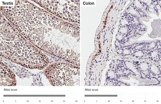 PGP9.5 Antibody in Immunohistochemistry (Paraffin) (IHC (P))