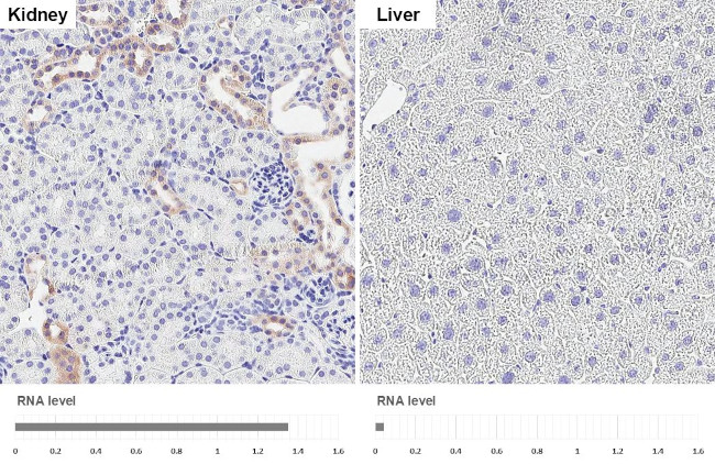 PHACTR1 Antibody in Immunohistochemistry (Paraffin) (IHC (P))