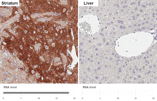 PHACTR1 Antibody in Immunohistochemistry (Paraffin) (IHC (P))
