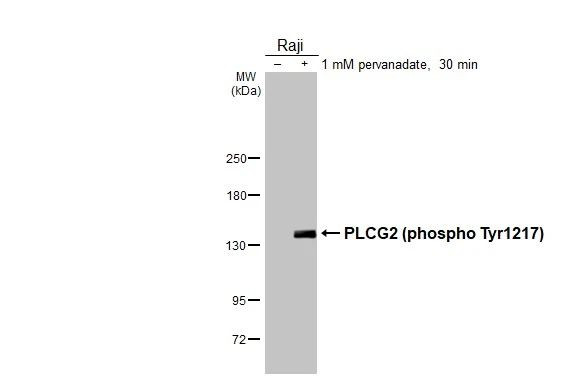 Phospho-PLCG2 (Tyr1217) Antibody in Western Blot (WB)
