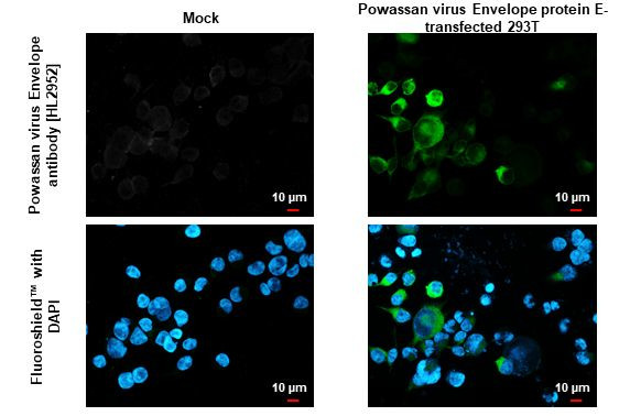 Powassan Virus Envelope (Strain#LB) Antibody in Immunocytochemistry (ICC/IF)