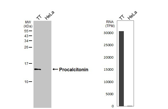 Procalcitonin Antibody in Western Blot (WB)