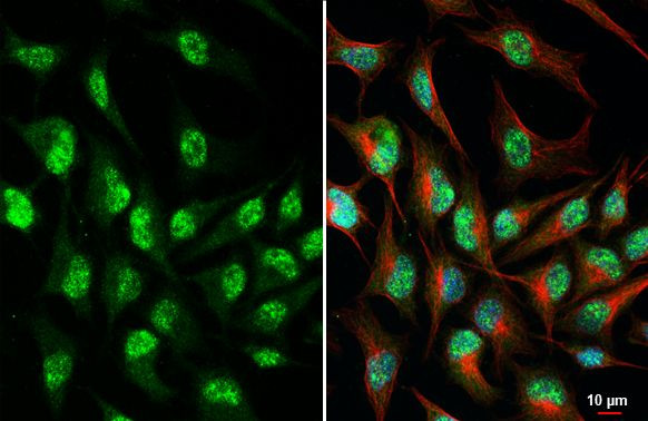 Rb Antibody in Immunocytochemistry (ICC/IF)