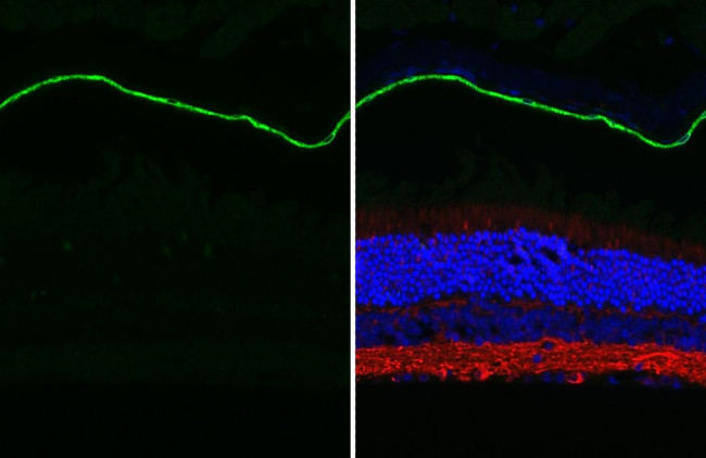 RGR Antibody in Immunohistochemistry (Paraffin) (IHC (P))
