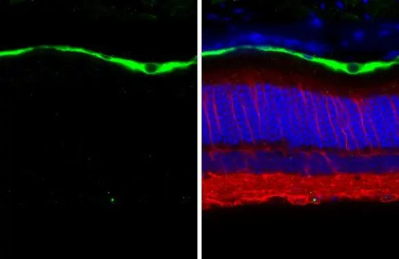 RGR Antibody in Immunohistochemistry (Paraffin) (IHC (P))