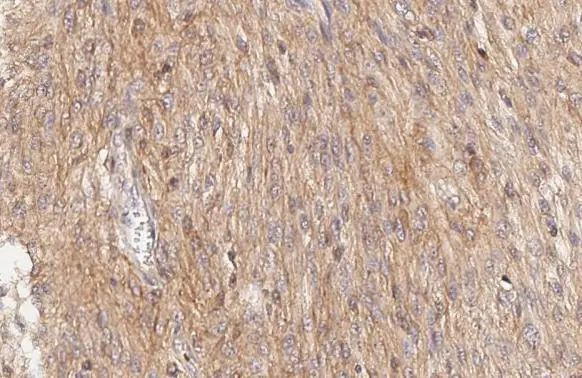 SMO Antibody in Immunohistochemistry (Paraffin) (IHC (P))