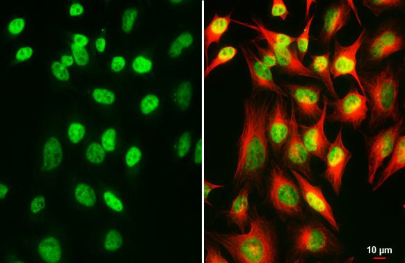 SP2 Antibody in Immunocytochemistry (ICC/IF)