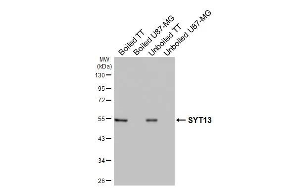 SYT13 Antibody in Western Blot (WB)