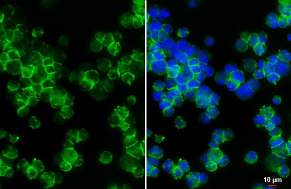 TGFBR3 Antibody in Immunocytochemistry (ICC/IF)
