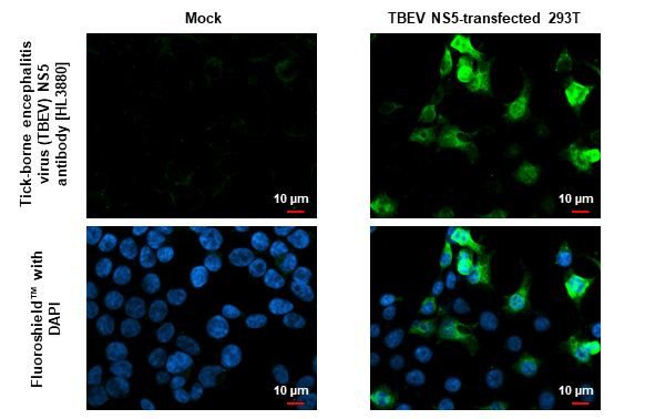 Tick-Borne Encephalitis Virus NS5 Antibody in Immunocytochemistry (ICC/IF)