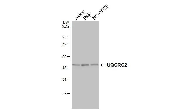 UQCRC2 Antibody in Western Blot (WB)