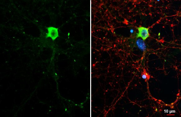 WAVE1 Antibody in Immunocytochemistry (ICC/IF)