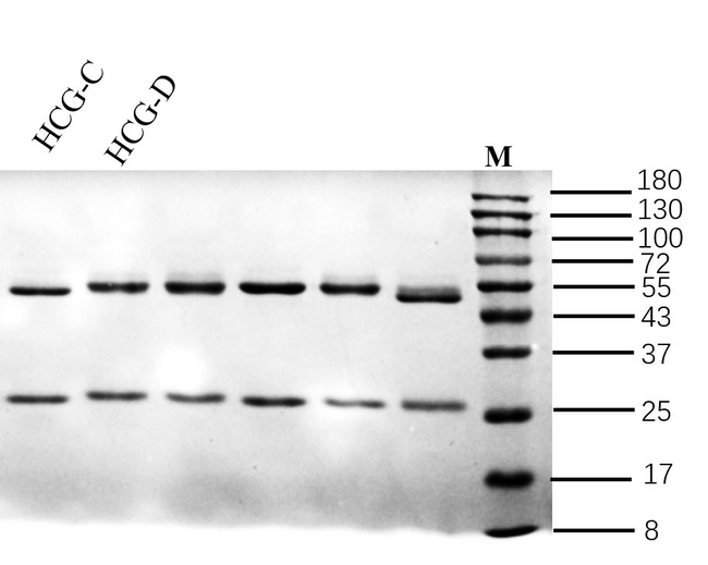 hCG Antibody in SDS-PAGE (SDS-PAGE)