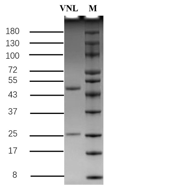 Vinillin Antibody in SDS-PAGE (SDS-PAGE)