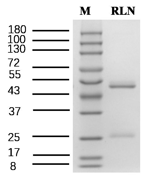 Repaglinide Antibody in SDS-PAGE (SDS-PAGE)