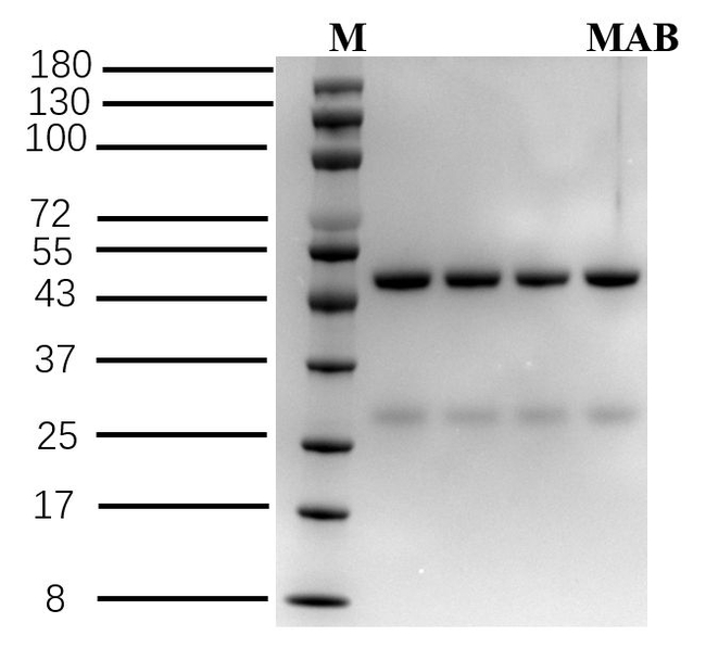 Mabuterol Antibody in SDS-PAGE (SDS-PAGE)