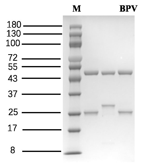 Bupivacaine Antibody in SDS-PAGE (SDS-PAGE)