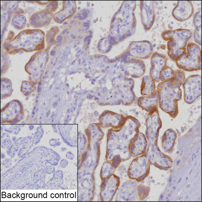 hCG beta-7 Antibody in Immunohistochemistry (Paraffin) (IHC (P))